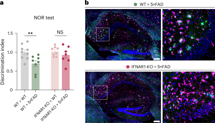 LabWaggoner's tweet photo. Alzheimer’s disease disrupts myeloid cell production in bone marrow via type I IFN, preventing protective macrophages from reaching the brain
https://t.co/4HuibVl7ok
https://t.co/eDDnT495gA @NatureNeuro @ADeczk @maabellanas @WeizmannScience @basurco_leyre @institutpasteur
@unav https://t.co/IDiL1dufTh