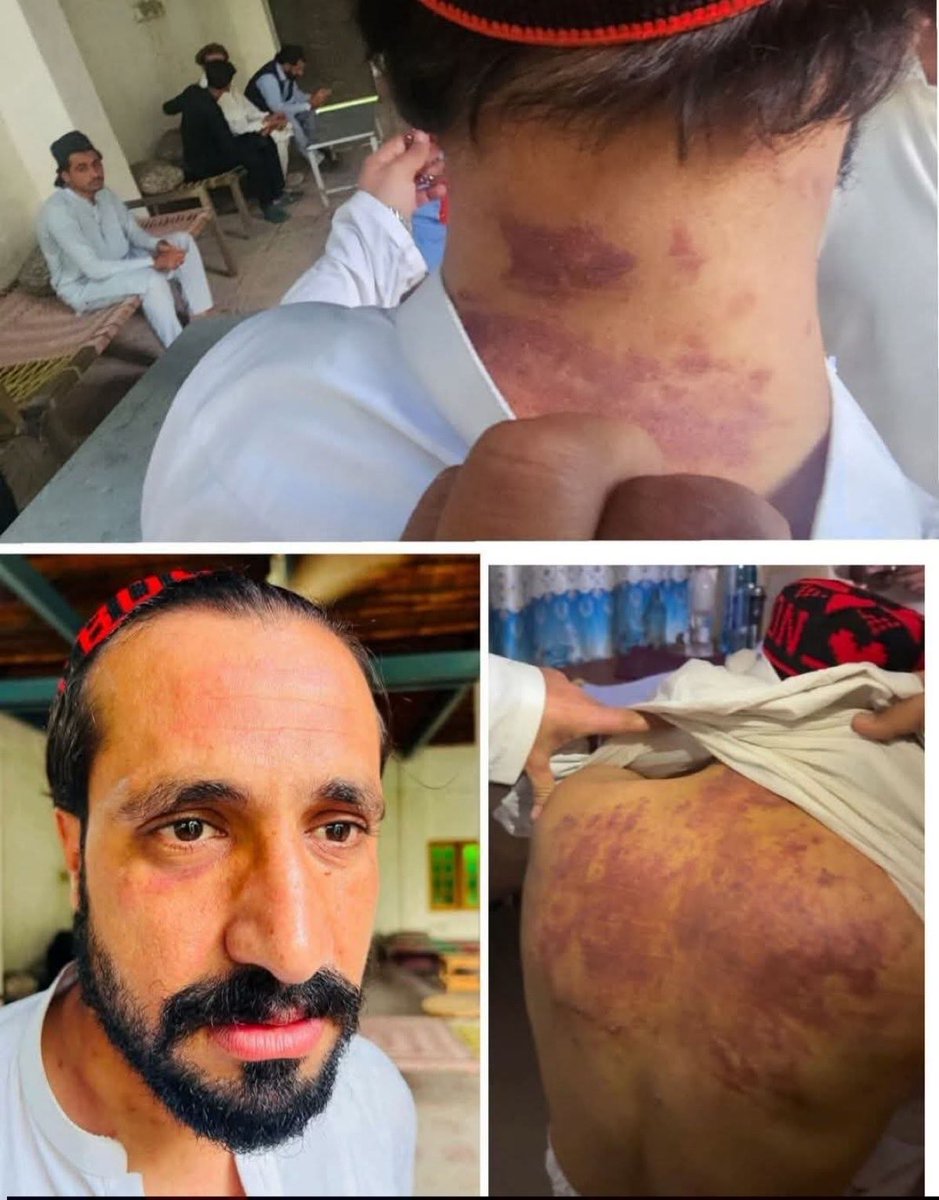 ikramkhatana75's tweet photo. کسی بھی شخص کو دوران مِ حراست/قید تشدد کا نشانہ بنانا ناصرف غیرقانونی بلکہ جرم ہے۔

میں بطور سیاسی کارکن نجیب اورکزئی (مجبور پشتون) کے ساتھ ہونے والے مبینہ تشدد ناصرف مذمت کرتا ہوں بلکہ ذمہ داران کو سزا کا مطالبہ کرت ہوں https://t.co/NjWtKFHAZ8