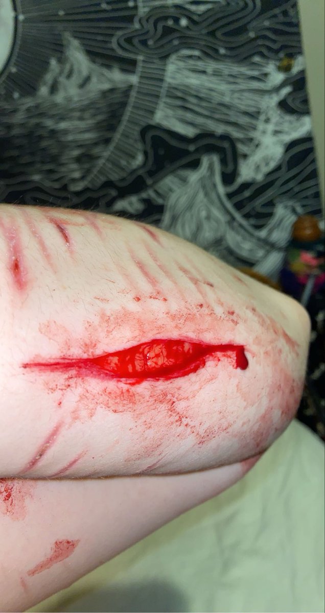 paperbageraa's tweet photo. one of my gnarliest of slices. from a few years ago

100% sfx makeup ai enhanced https://t.co/wFwZmigYPb