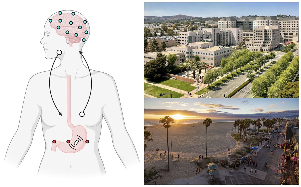 KhalsaLab's tweet photo. Postdoc job alert! I’m looking for someone with a PhD in neuroscience/psychology, psychiatry, computational modeling or a related field to join my NIH-funded team at UCLA studying the neural &amp; computational mechanisms of #interoception in anorexia nervosa 1/2 https://t.co/bM9CcORkA6