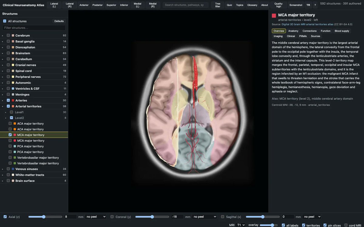 batuhanayci's tweet photo. A 3D neuroanatomy atlas that runs in a browser. Everything is in MNI152 space, the same coordinates as the template MRI, so the model and the scan correspond and you can move between them.

https://t.co/4bCy6eMjAW https://t.co/7cRKwZX0Dw