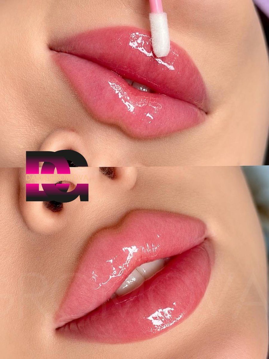 kaan_ferdi's tweet photo. Full Face: MXN 10, 500. I’ll be working in Cancún on August 8, 9, and 10. I won’t be back for another 3–4 months after that. 5 ml + Botox = Goodbye tired-looking face

The Full Face combo restores lost volume naturally—not an overdone look. Cheek https://t.co/1kiuCBPNTc