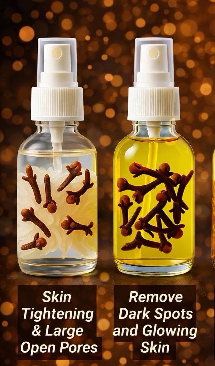 shyam_ayurved's tweet photo. Clove Toner For Glowing Skin!

Boil 1 tbs cloves in 1 cup water (5min). Cool, strain, pour into spray bottle. Use at night.

Eugenol flights acne bacteria &amp; inflammation (lab-backed).

Traditional use brightening, pour care!

⚠️Patch test first - can irritate skin. https://t.co/iLz0VkjyKY