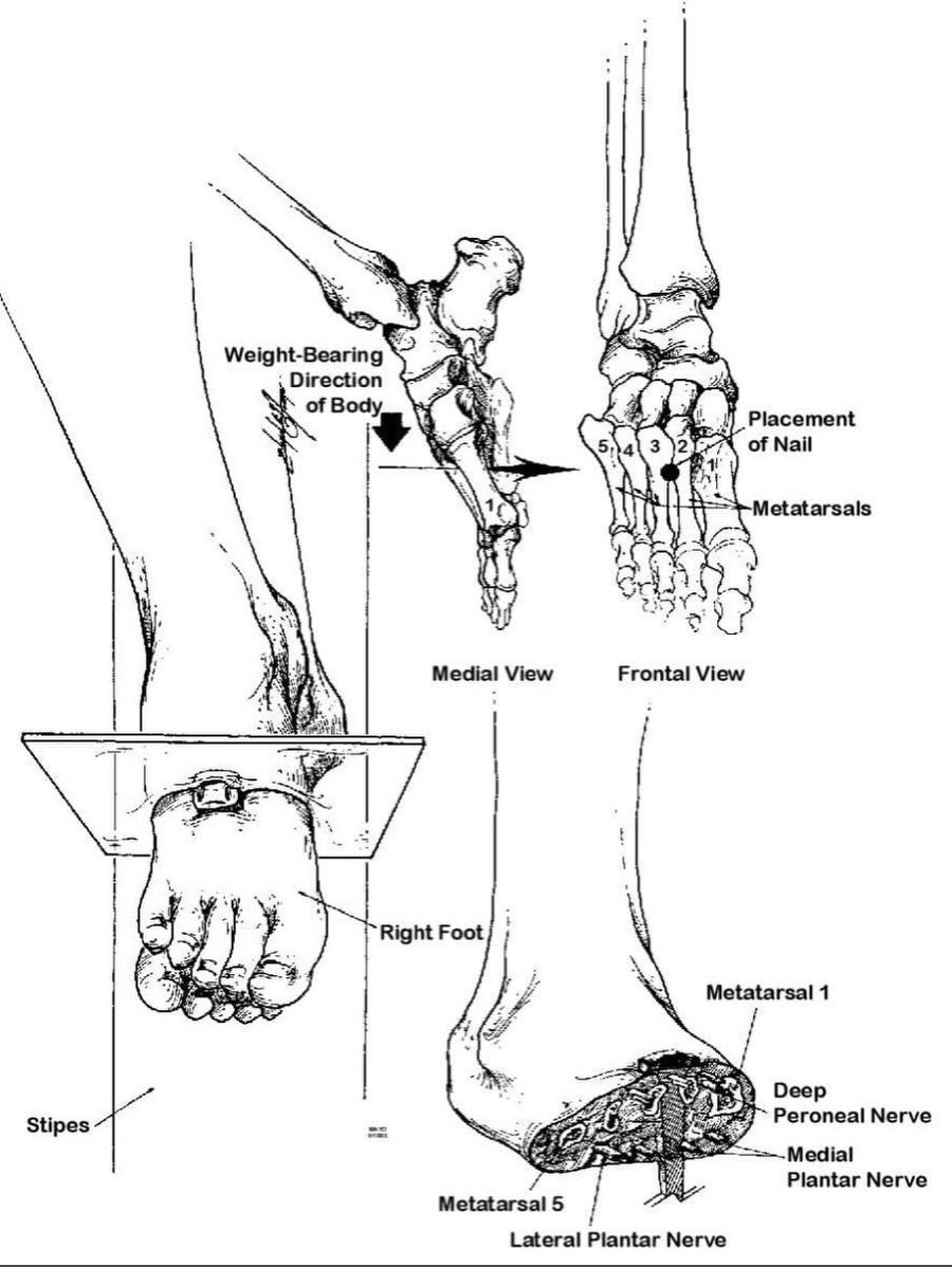NurseTorture's tweet photo. Diagrams from "On the Physical Death of Jesus Christ" https://t.co/Ik5hVqZ5XE
