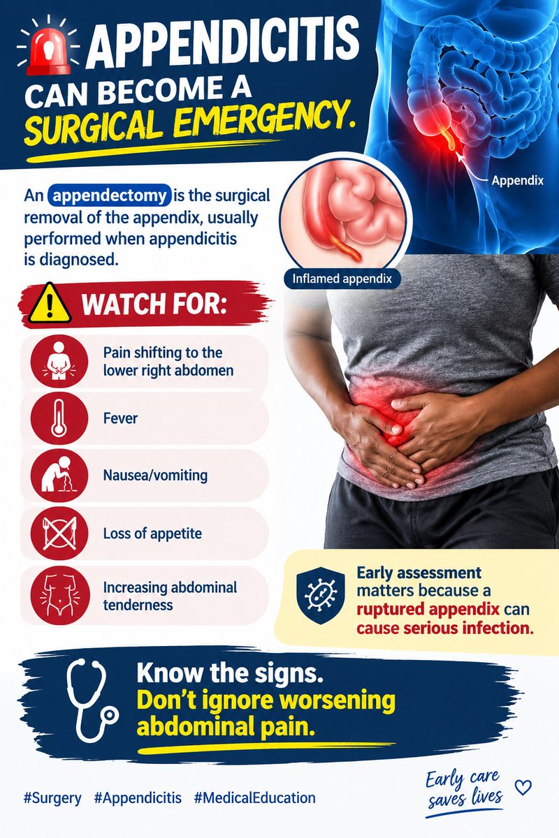 SeredeHarris's tweet photo. 🚨 APPENDICITIS CAN BECOME A SURGICAL EMERGENCY.

An appendectomy is the surgical removal of the appendix, usually performed when appendicitis is diagnosed.

⚠️ Watch for:
• Pain shifting to the lower right abdomen
• Fever
• Nausea/vomiting
• Loss of appetite
• Increasing abdominal tenderness

Early assessment matters because a ruptured appendix can cause serious infection.

🩺 Know the signs. Don’t ignore worsening abdominal pain.

#Surgery #Appendicitis #MedicalEducation
