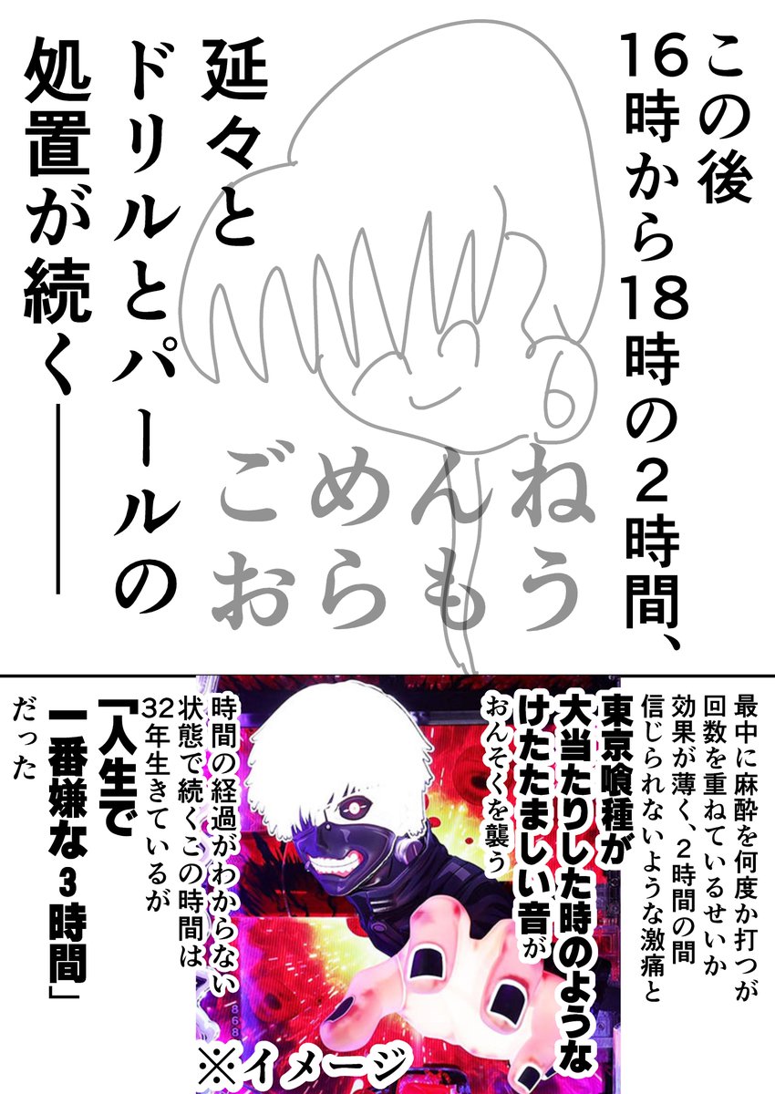 carupisu966966's tweet photo. 地獄の親知らず抜歯レポ
～暗黒編～ https://t.co/HvHykatF9Z