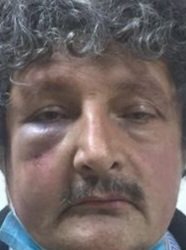 seyfulla_hattat's tweet photo. NORM FAZLASI POLİS +BELEDİYE ÇALIŞANLARI işbirliği İLE ÇETELESME. Bu işkence olayına karışanlarsa Tutuklanmadi Bahçelievler belediyesi çalışanı Adnan Arı ya hiçbir işlem yapılmamış..
NORM FAZLASI POLİS +BELEDİYE ÇALIŞANLARI işbirliği İLE ÇETELESME. Bu işkence olayına karışanlarsa Tutuklanmadi Bahçelievler belediyesi çalışanı Adnan Arı ya hiçbir işlem yapılmamış...
https://t.co/SXa9evaWe1
