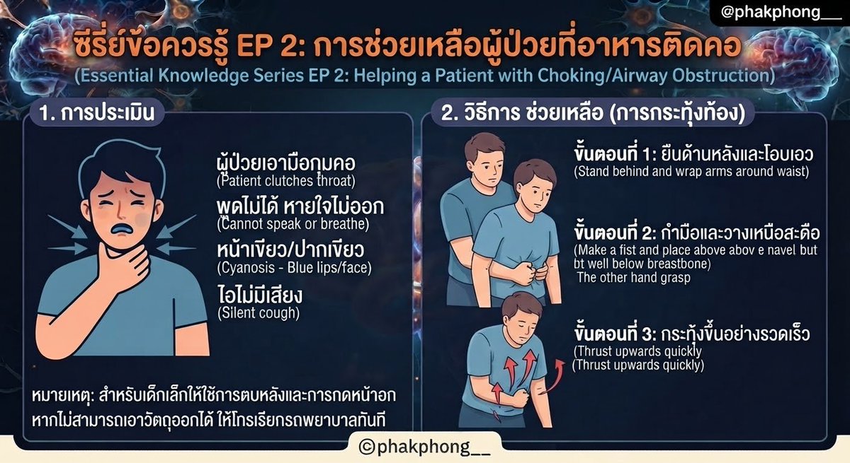phakphong___'s tweet photo. 📚When someone chokes: ❌Never slap back while bending forward! Check if they can't speak 🗣️, breathe 😮‍💨, or look blue 🔵. Use abdominal thrusts: stand behind, wrap waist, make a fist above navel, thrust up fast 🚨💪 #ข้อควรรู้EP2 #DEK70 #FirstAid https://t.co/YNLu8J6fiN