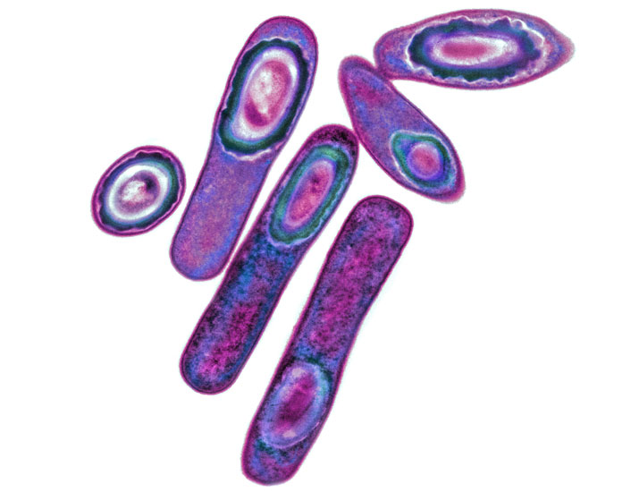 scisignal's tweet photo. New studies in mice show how C. difficile (#Cdiff), a main culprit in hospital-acquired infections, coordinates its response to low iron and the antimicrobial peptide #bacitracin to successfully colonize the gut. @VUMCDiscoveries https://t.co/3H1agf5aCt https://t.co/tLnDZyaGA4
