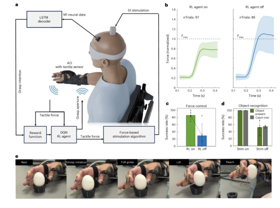 Surgeons implanted 5 electrode arrays in his brain

An AI detects when he intends to move and stimul...