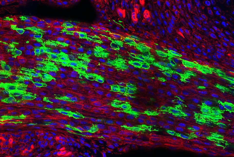 WCMCPathology's tweet photo. Exciting new @WeillCornell &amp; @HSpecialSurgery research identifies the #stemcells that give rise to tendons &amp; ligaments. Read “Newly Discovered Stem Cell Reveals Potential Drug Target for #SpinalStenosis” featuring Dr. Matthew Greenblatt and colleagues.
https://t.co/irWGKjFLTS https://t.co/biX7gbY5mk