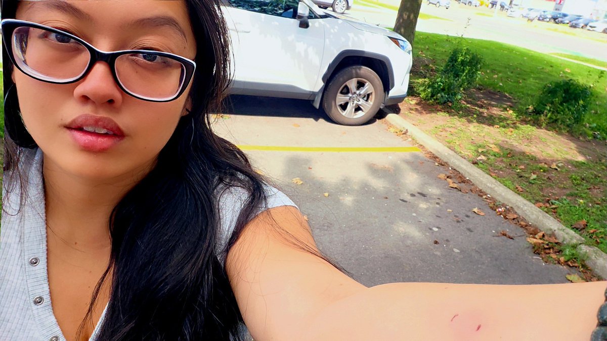 PreciousLesko's tweet photo. Celebrating my degree was the fun part. Now comes the administrative reality. 💉📋

​Four clinic visits, a TB test, and waiting on vulnerable sector checks to clear before I can start my next community role. The unglamorous behind-the-scenes work nobody talks about, but one step closer!

​When I was a teenager, I helped found a youth group at my church where we’d visit local long-term care homes to sing, play music, and spend time with the residents. Getting cleared to support daytime activities in senior care feels like coming full circle.

​Fingers crossed everything clears smoothly soon! 🤞 

#LongTermCare #VolunteerLife #CommunitySupport #SeniorCare #GivingBack