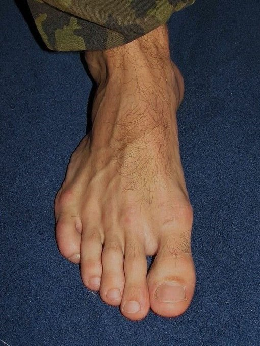 CoachDanCole_'s tweet photo. Signs that your heart is more than good:

1. Very hairy fingers https://t.co/TYIKvRUoVi