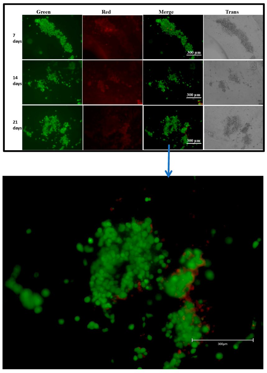 Bioeng_MDPI's tweet photo. π¨οΈ 3D alginate/gelatin scaffold: skin cells viable at 21 days, higher melanin vs 2D, Keratin 10 expressed.
π https://t.co/cz603ieMkT
#3DBioprinting #TissueEngineering #WoundHealing https://t.co/jW2rMAxzsR