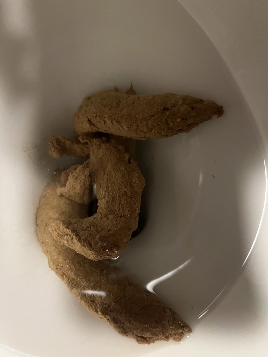 luke2joseph1's tweet photo. Poop Update https://t.co/BlIJDlqtyR
