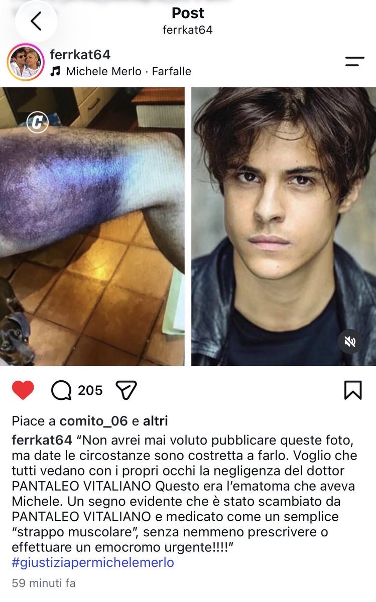 isthemoonlight's tweet photo. Tutti devono conoscere Michele Merlo e la sua tragica storia. Con quei lividi lo hanno mandato a casa. Non una ma più e più volte. Dicevano che stava esagerando, anche quando ormai era a terra che rantolava. I medici vedendolo in fin di vita ridendo gli dissero di non drogarsi https://t.co/uvVuqAtGjF