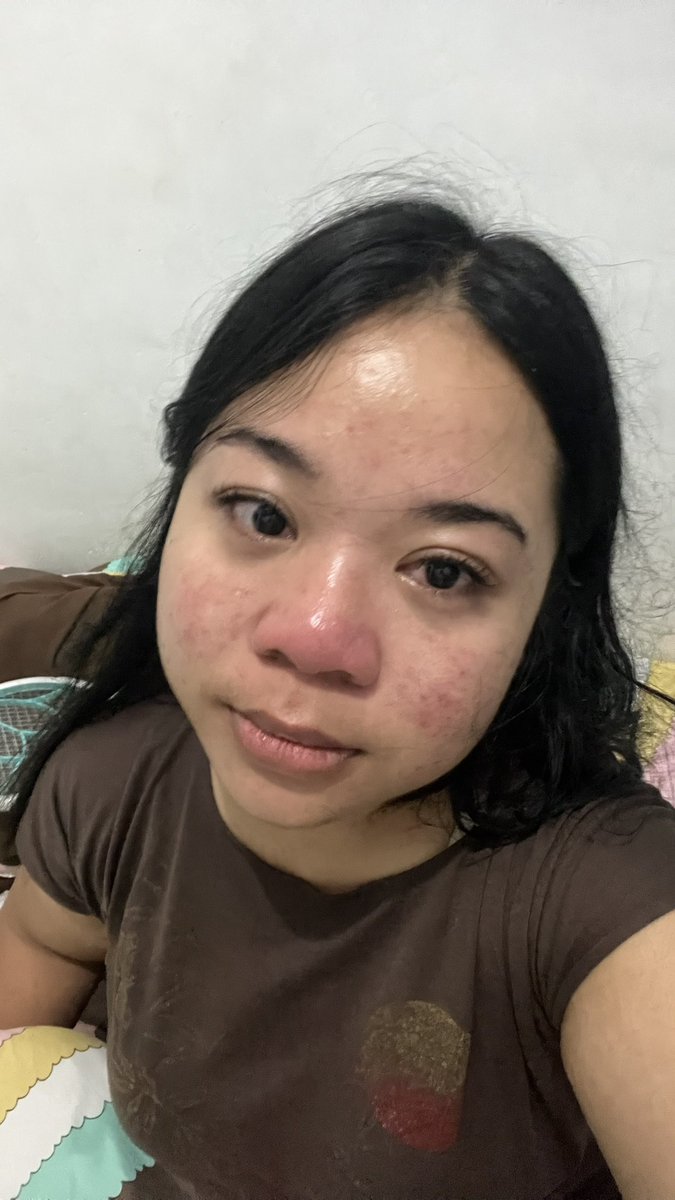messsyy91's tweet photo. malem nangis, bangun tidur bengep, alhamdulillah pas make up sudah kembali normal
eee sore nangis lagiii🤣🤣 https://t.co/pxyeQ34wCD