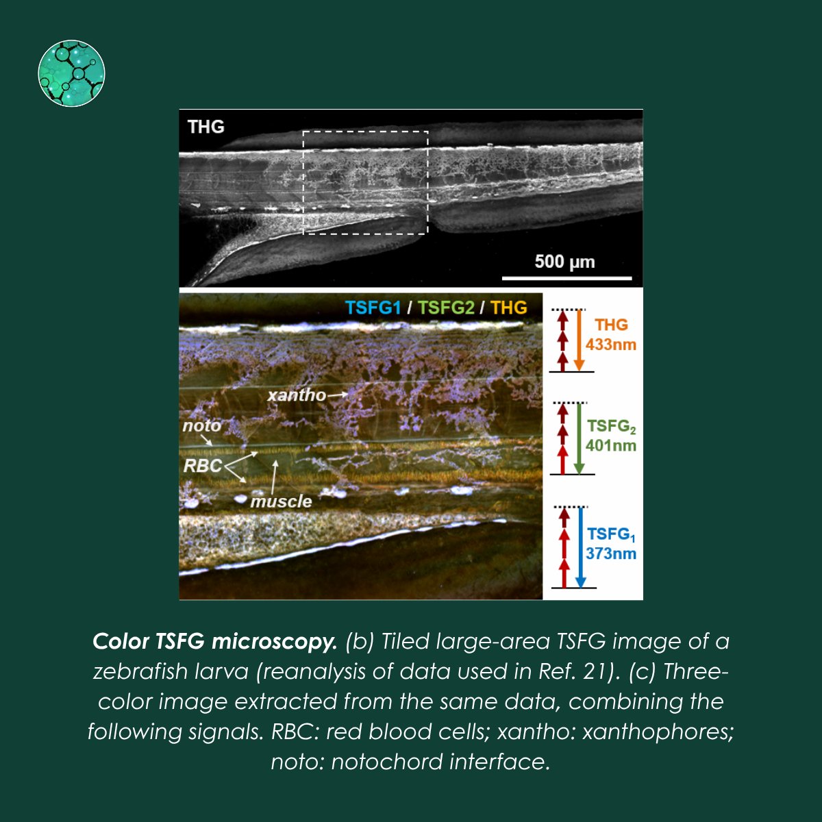 Fr_BioImaging's tweet photo. [PUBLI] Researchers at the LOB has shown that THG microscopy, mainly used to visualize tissue structure, can also help distinguish certain pigments.

This opens new possibilities for label-free multiphoton imaging.

Read more 👉 https://t.co/GUnRSRnmko https://t.co/S6gFJ3Wkfd