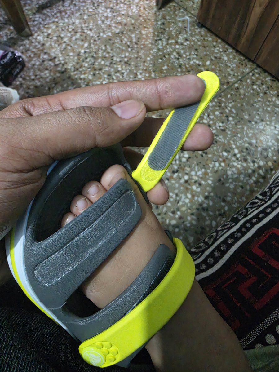 rishabhg06's tweet photo. @CrocsIndia I bought a pair of sandals from Crocs just a few days ago, and the Velcro on the foot strap has already come off due to poor quality. My child can no longer wear them.

I’m also attaching the payment message received at the time of purchase. No proper bill/invoice was provided to me by Crocs India.

This is extremely disappointing from a brand like Crocs. Please look into this and provide a resolution.

Bought it from Spectrum Mall, sector 75 Noida.