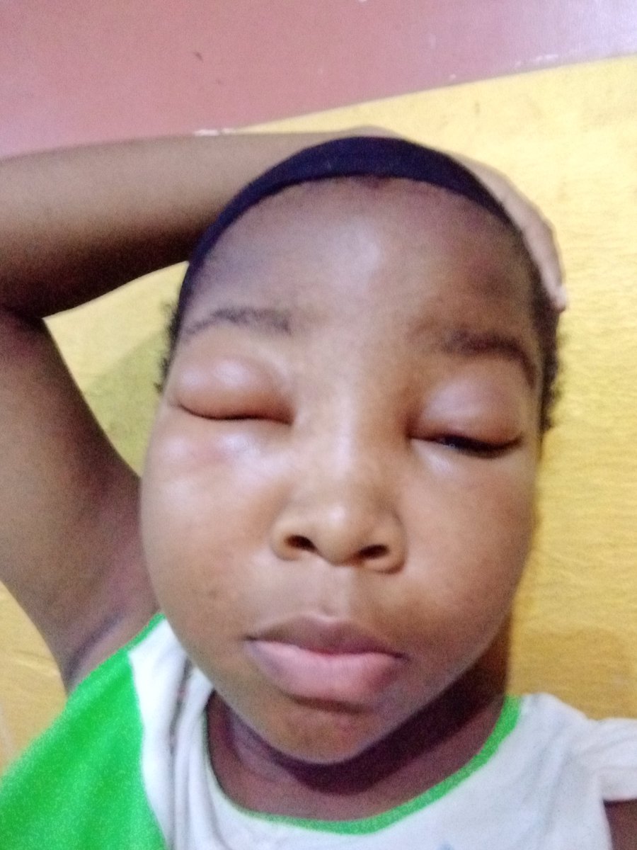 BlessingUd7584's tweet photo. I have been fighting kidney failure for almost 2 years now and I urgently need financial help for an Overdue medical checkup and health needs etc.  If you can support me in any way, I'd be deeply grateful. 
Thank you and God bless. 

2245981333
U.B.A
Chizaram Blessing Udo https://t.co/Sj0GK2hwVb