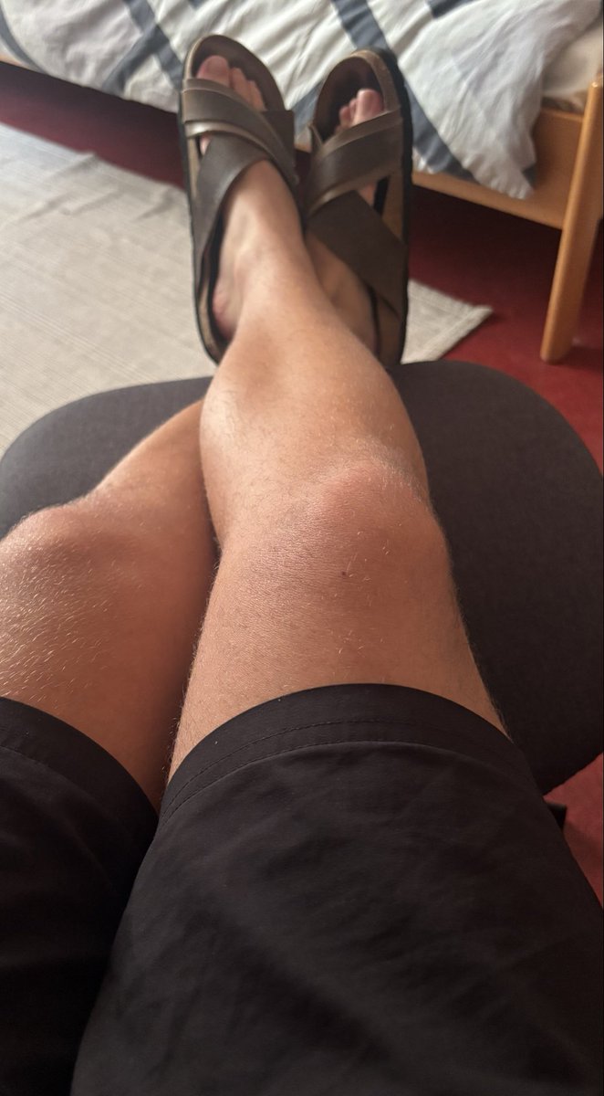 FeetMastermh's tweet photo. These feet own you.
Not the other way around.
Open your fucking mouth.
DM me for more, fag!😈🔥

#Feet #FootFetish #MaleFeet #Soles #BareFeet #Sandals #GermanFeet #FeetForSale #dom #jock #feetworship #alpha #master https://t.co/FNmNcJCPdg