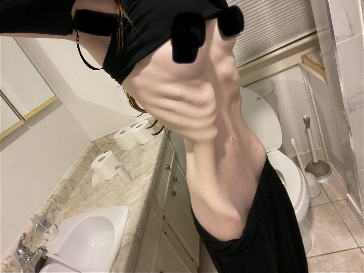 dolley_1ey's tweet photo. Bmi guesses? #edrtwt 😅 https://t.co/KGmRflvjrL