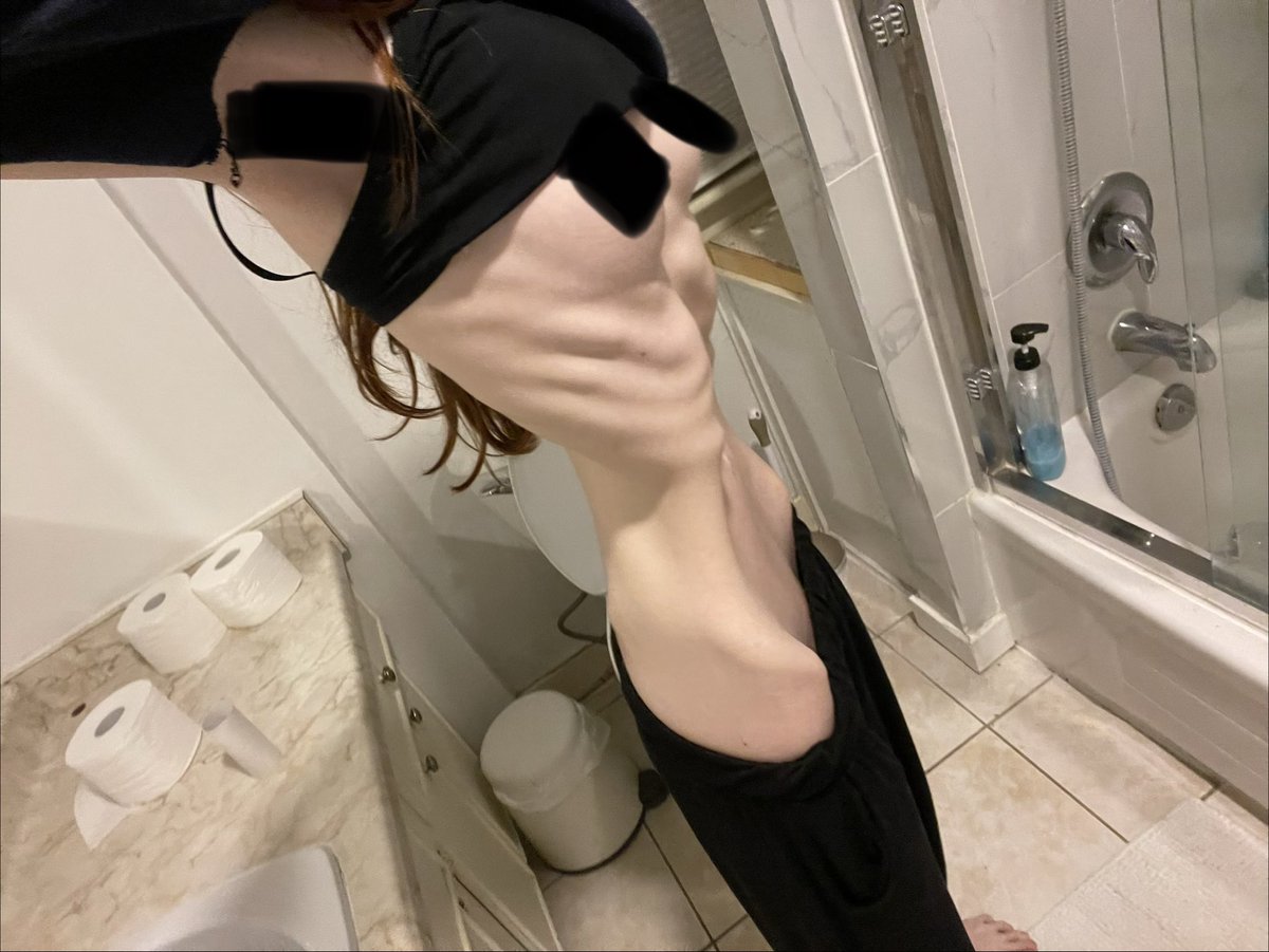 dolley_1ey's tweet photo. Bmi guesses? #edrtwt 😅 https://t.co/KGmRflvjrL