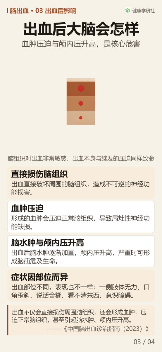 HealthResLab's tweet photo. ���出血，真的都是摔出来的吗？
最常见的病因是长期高血压让小血管玻璃样变、变脆，收缩压超过 180 mmHg 时最容易破裂出血。
四屏讲清最常见的病因、动脉瘤与血管畸形等少见原因，以及突发头痛呕吐时第一时间该做什么。

#脑出血 #高血压 #脑动脉瘤 #脑动静脉畸形 https://t.co/NVbl5FUFcj