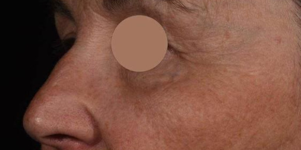 CrodaPC's tweet photo. What matters when evaluating a skincare active?

How visible are the results? How easily does it formulate? Do the benefits last?

Matrixyl® Neolide™ got us thinking beyond “how quickly does it work?”

Formulators, cosmetic scientists: what matters when assessing a new active? https://t.co/l8ZoBC4gOO