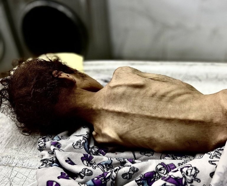 Eyeongaza2's tweet photo. Never forget children of Palestine. https://t.co/q7PiZ3Flqd