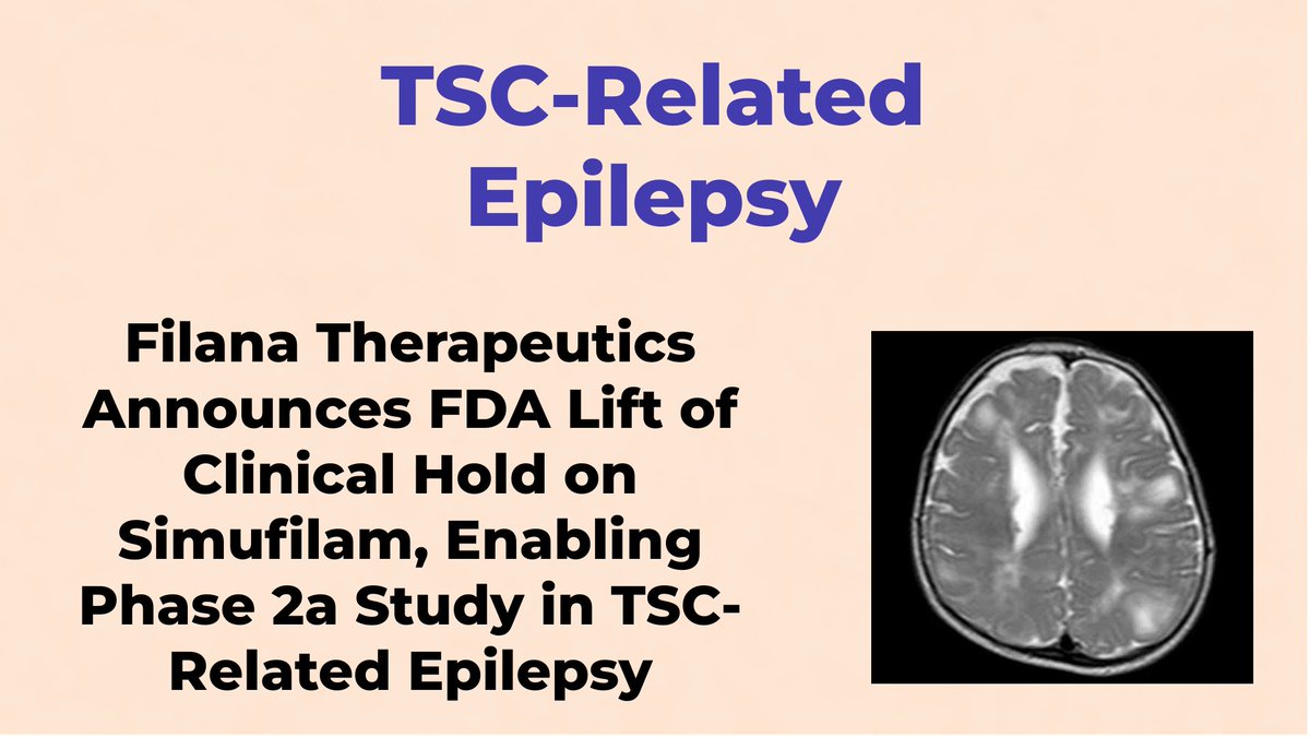 CheckOrphan's tweet photo. Filana Therapeutics Announces FDA Lift of Clinical Hold on Simufilam, Enabling Phase 2a Study in TSC-Related Epilepsy - For More Information Visit  https://t.co/Mpi9w2rfqr  #Filana_Therapeutics  #Rare_diseases  #FDA  #Orphan_Drugs  #Epilepsy  #TSC_Related_Epilepsy  #Simufilam https://t.co/mOCymn9BNL