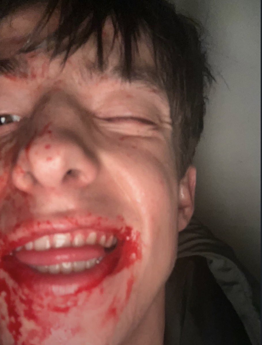 ryanaimful's tweet photo. they were so happy to be covered in blood https://t.co/YW8q8vKUcr