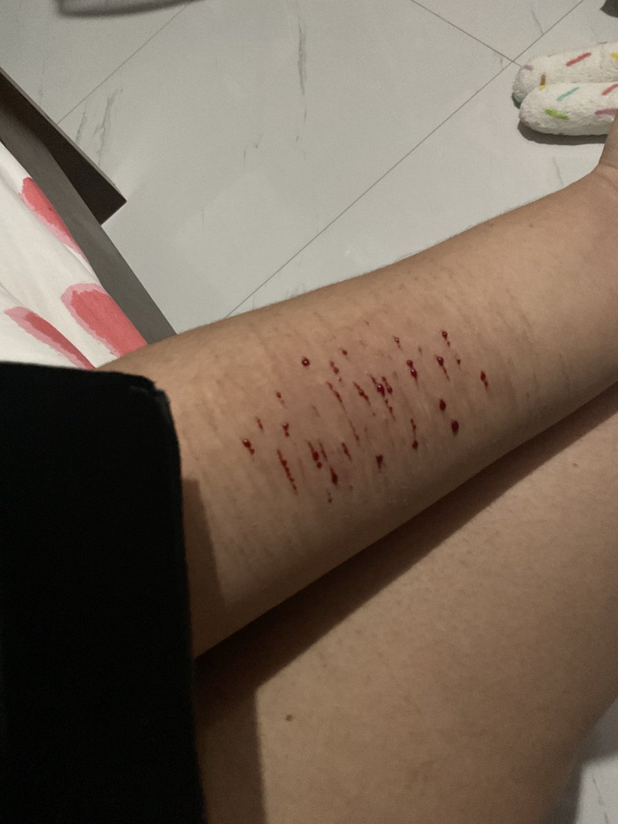 happiesturethan's tweet photo. Little fake makeup after not making one for a while lol
#shtwt #sh #cuttwt #slittwt #slit #fake https://t.co/oQODUkVZX7