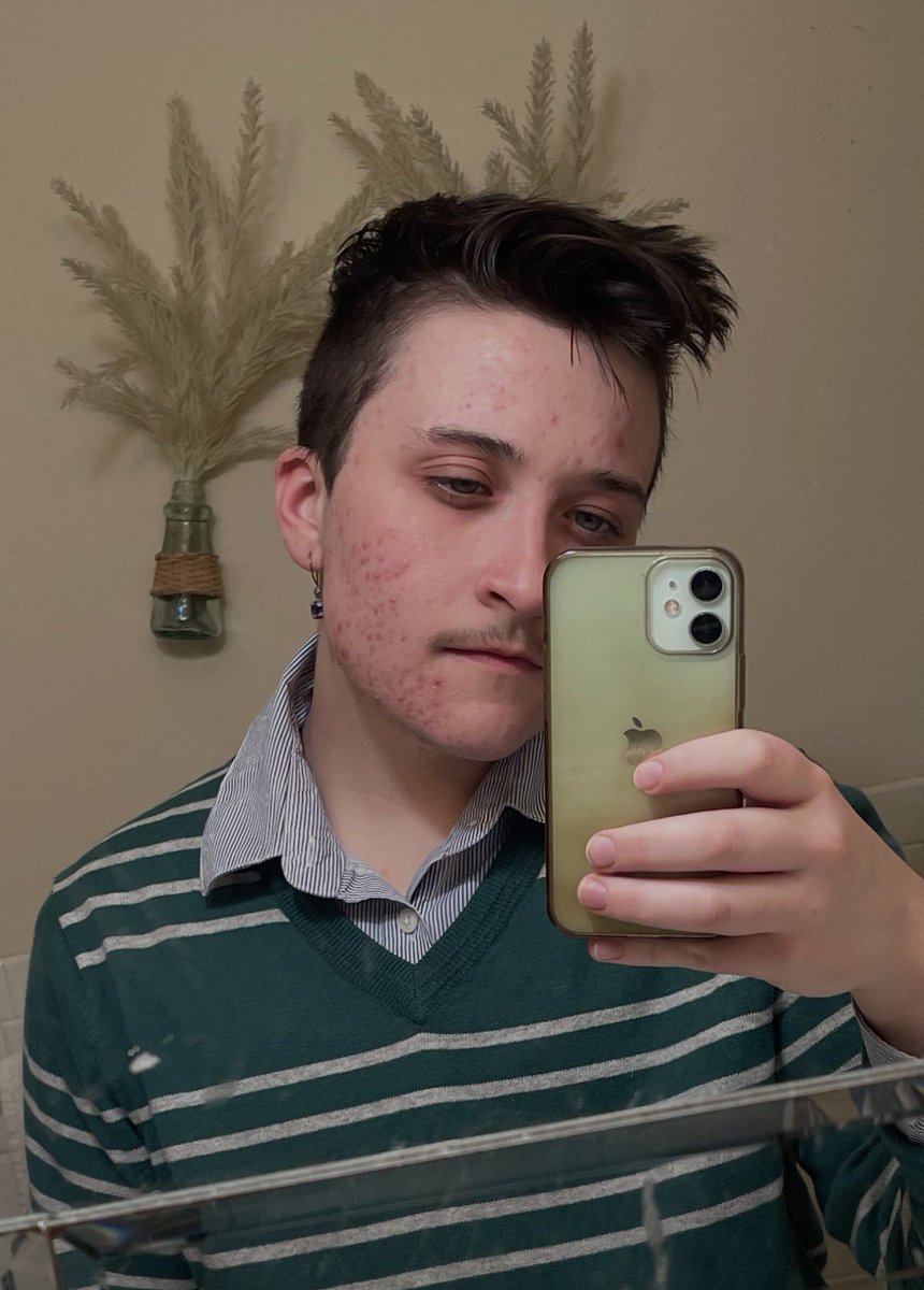 toasteredbread's tweet photo. my truth is that going on T did exacerbate my acne for the first like year (6 months vs 5 years here)I was already prone 2 acne. So nut up and visit the dermatologist or wait a few years and you’ll be fine. When you visit the puberty store you get puberty… quelle surprise. https://t.co/4BS2yV37O9