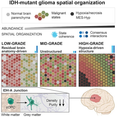 Cancer_Cell's tweet photo. Spatial analysis reveals the evolving organization of IDH-mutant glioma https://t.co/AX6uc6ZCm8 https://t.co/nbMBRnRNE5