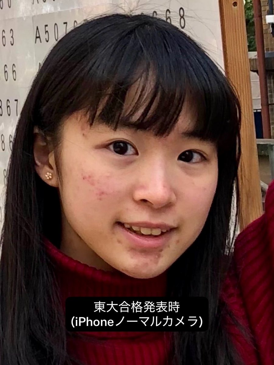 sakuramochisara's tweet photo. ちなみに、高校生クイズの視聴者の方々に「ニキビちゃん」と呼ばれていたらしく、当時の私はぐうの音も出ず😅
大学受験まで酷いニキビでした(1枚目)が、肌にあったスキンケアと食べ物の調整で綺麗になった(2枚目)ので、いまニキビに悩んでいる中高生の希望になれると嬉しいです💪 https://t.co/rWh1SCt5I2