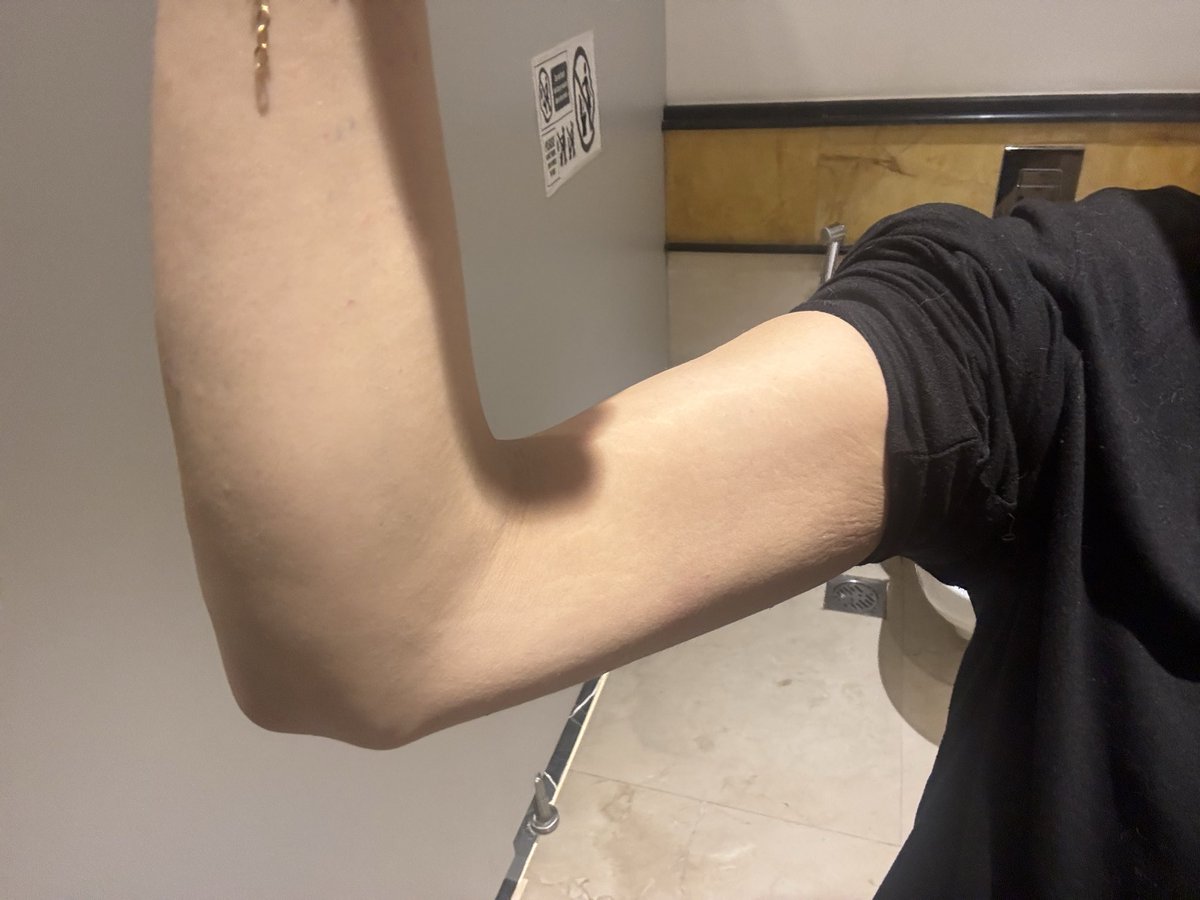 yukiisfine's tweet photo. before and after
 but i’m flexing in the second pic so it’s kinda inaccurate https://t.co/UNwaEQYxnq