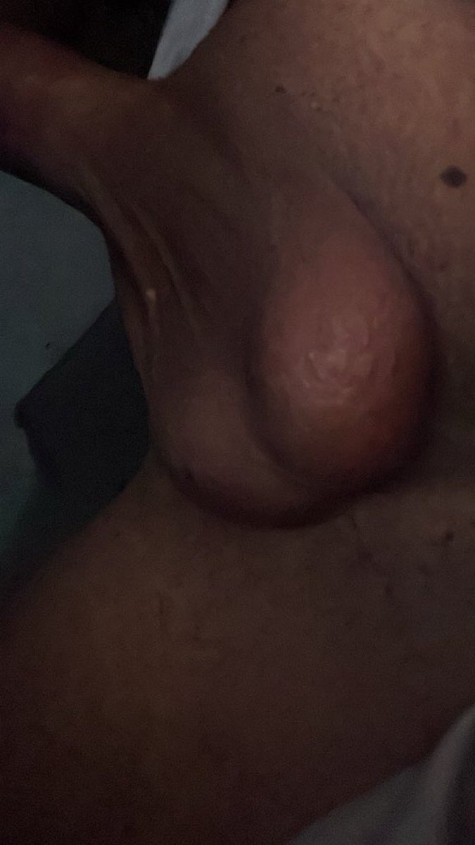 Noybwnc's tweet photo. خصياني طايحه من الحر 😣 https://t.co/NLevn4yuM2