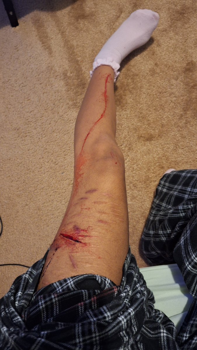 strwbrykitkat's tweet photo. so THIS happened

#shrtwt #slittwt ⚠️ALL FAKE AI PHOTOSHOP ITS NOT REAL SFX MAKEUP⚠️🙂 https://t.co/07XFI7ZaNF