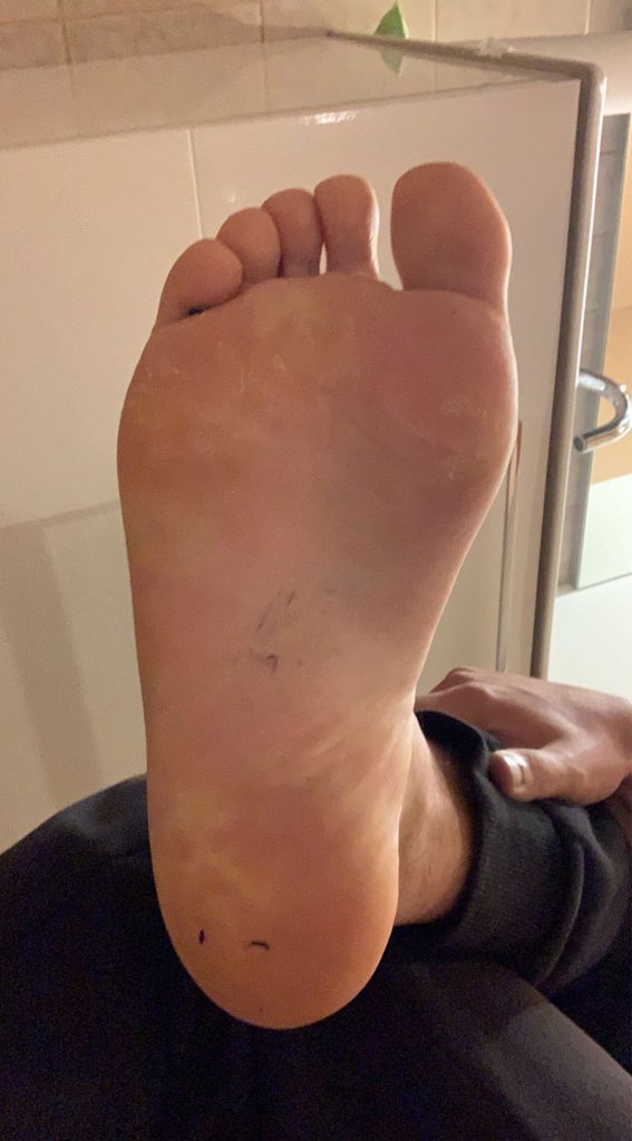 PatronAbdel91's tweet photo. Ils sont où les nettoyeur de sket et les bouffeur de 🦶🏽 https://t.co/SKoo1bCoO3