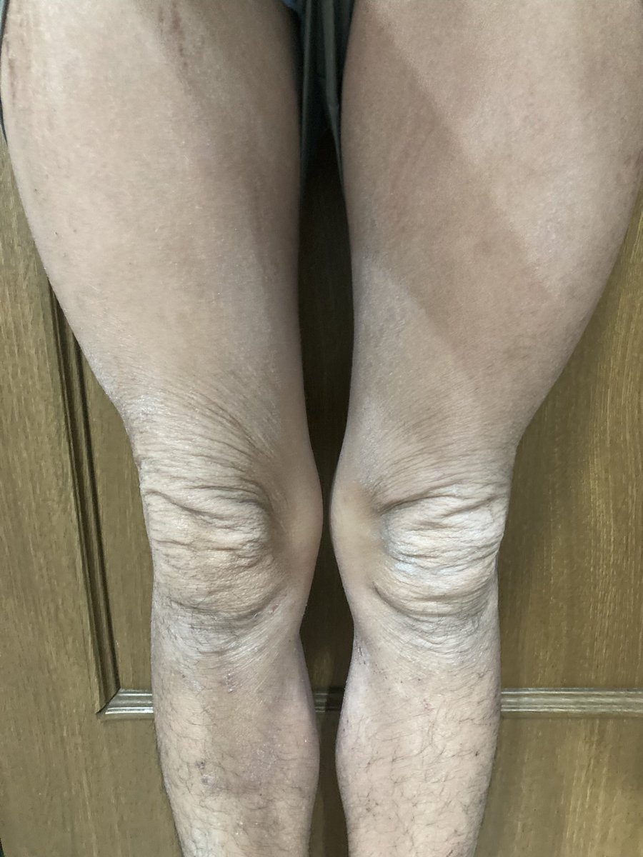 Tiktok_mei's tweet photo. 17歳なのに膝ジジイすぎる助けて https://t.co/yFcDAfp3v1