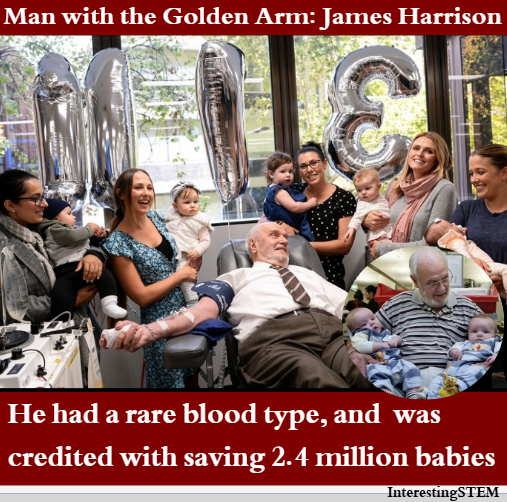 InterestingSTEM's tweet photo. The Man with the Golden Arm: James Harrison

James Harrison had a rare blood type and was credited for saving 2.4 million babies.

His blood contained a unique and powerful antibody called Anti-D, which prevents hemolytic disease of fetus and newborn (HDFN)- a fatal condition where a pregnant mother's immune system attacks her unborn baby's blood cells.