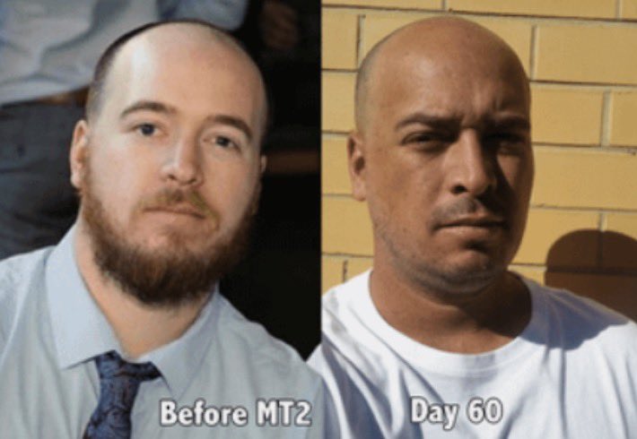 foidkilling's tweet photo. @MemeStealerOG @bohfah @grok Skin pigment ≠ race you fucking moron 
Is this guy magically African now ?
No because he still has European genetic ancestry and genetically clusters in that racial group
Youre just a low iq brown retard https://t.co/acAD1EeVQh