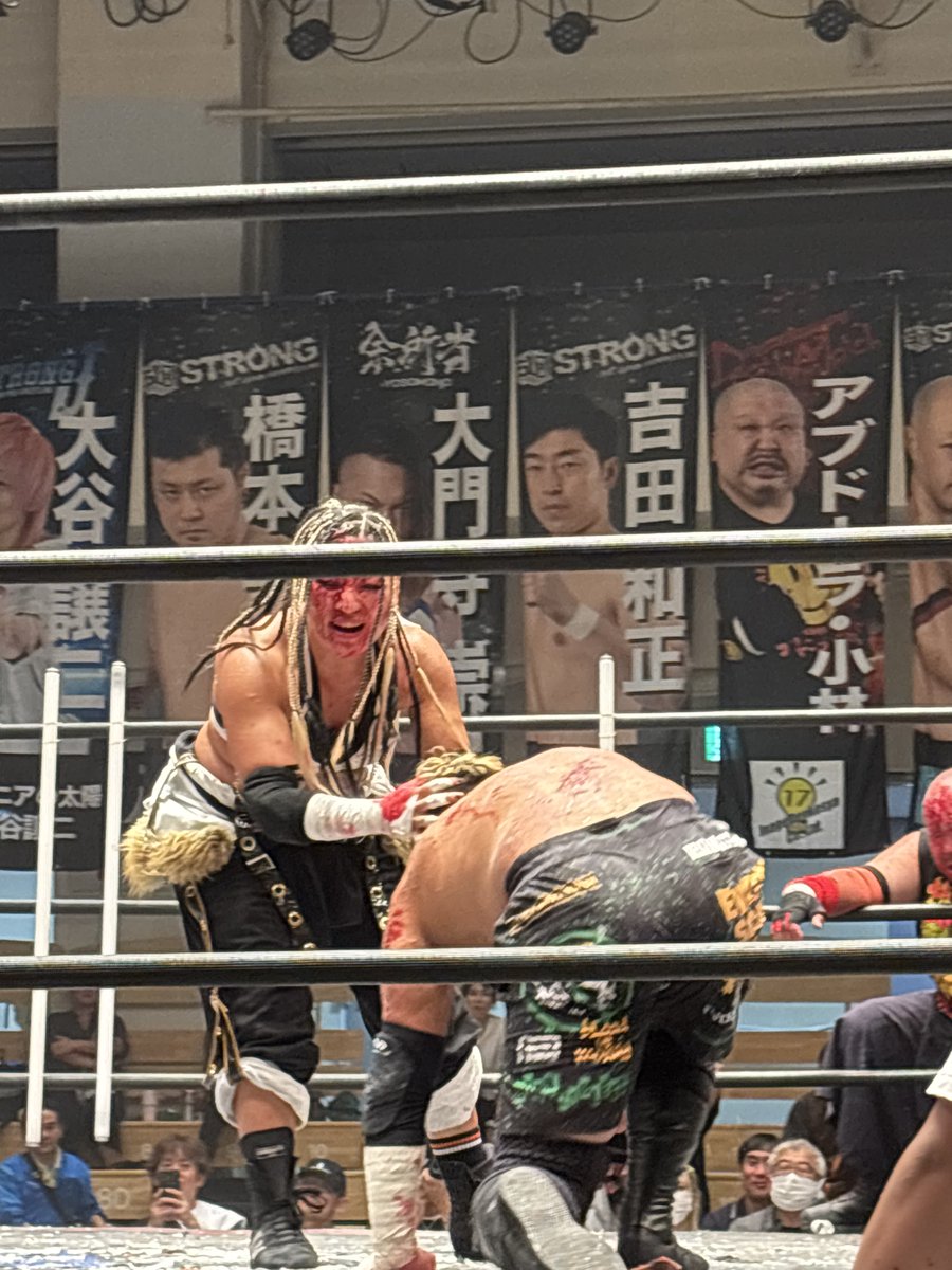 wwafc1's tweet photo. 山下りな選手、
顔面整形ではなく包○手術‼️
#bjw https://t.co/CxW6aWQMHE