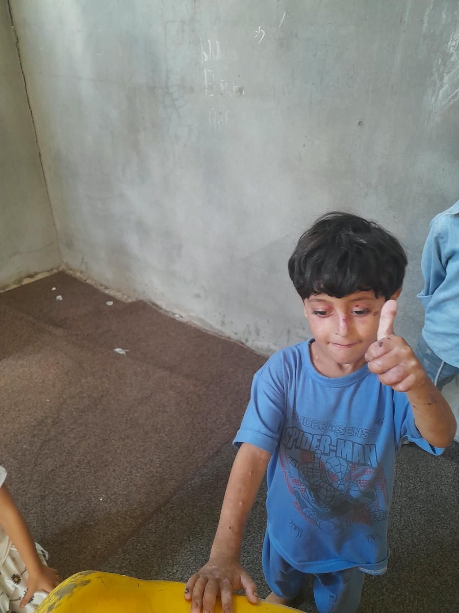 idz42t's tweet photo. 💙 Behind this smile is a little boy who needs safety and comfort. 🥺
Your donation, no matter how small, can help Tiam get what he needs. 🙏
If you can’t donate, please share his story. Every share can make a difference. 🤍 https://t.co/zepvVvyOEK