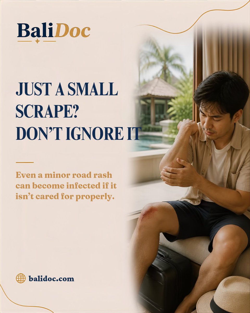 BaliDoc_'s tweet photo. Small scrape? Don’t let it turn into a bigger problem. 🩹🚨

Clean it. Cover it. Keep an eye on it.
If redness spreads, pain increases, swelling appears, or you notice pus or fever, it’s time to seek medical advice.

Had an animal bite or scratch? Ask about tetanus protection and rabies prevention. 🐕💉

Not sure what to do next? Talk to a doctor with BaliDoc Telehealth from your hotel, villa, or home. 💙

Visit https://t.co/FpHihAUM1w

#BaliDoc #RoadRash #WoundCare #TravelHealth #BaliTravel