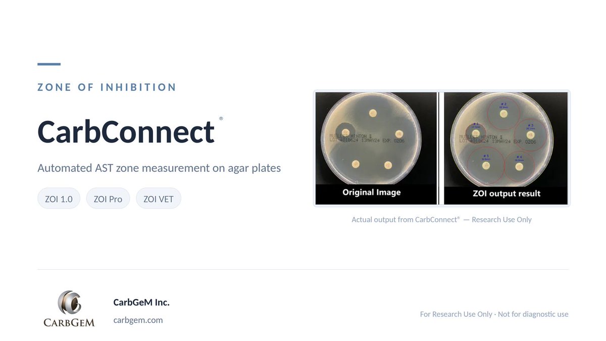 CarbConnect's tweet photo. ZOI 1.0 automates zone-of-inhibition measurement on Petri dish images — fewer calipers, less squinting at agar plates. Built for microbiology research workflows. RUO. One manual step removed from your AST bench routine.
#Microbiology #AST #RUO https://t.co/33B45L2Vm9