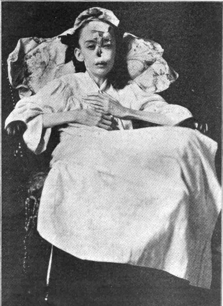 RBystrianyk's tweet photo. Vaccination. Do you know where it began?
You have a vague idea: A doctor created an injection that would forever stop smallpox.
But is that the real story?
What if I told you that right from the very beginning—and for over 100 years—doctors found it didn't work as promised, killing and injuring untold numbers as the idea became an unstoppable phenomenon. Those who bucked the system found themselves fighting a relentless juggernaut.
The history you've never heard:
https://t.co/pBx31yDyzq