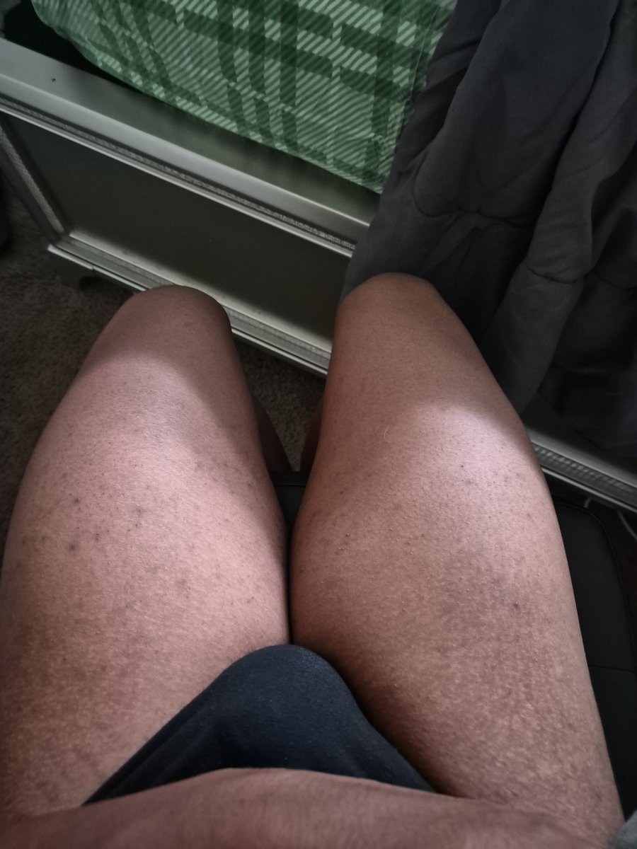 Dumidiot1's tweet photo. Meow #femboy #bulge https://t.co/00YrxLlhAm