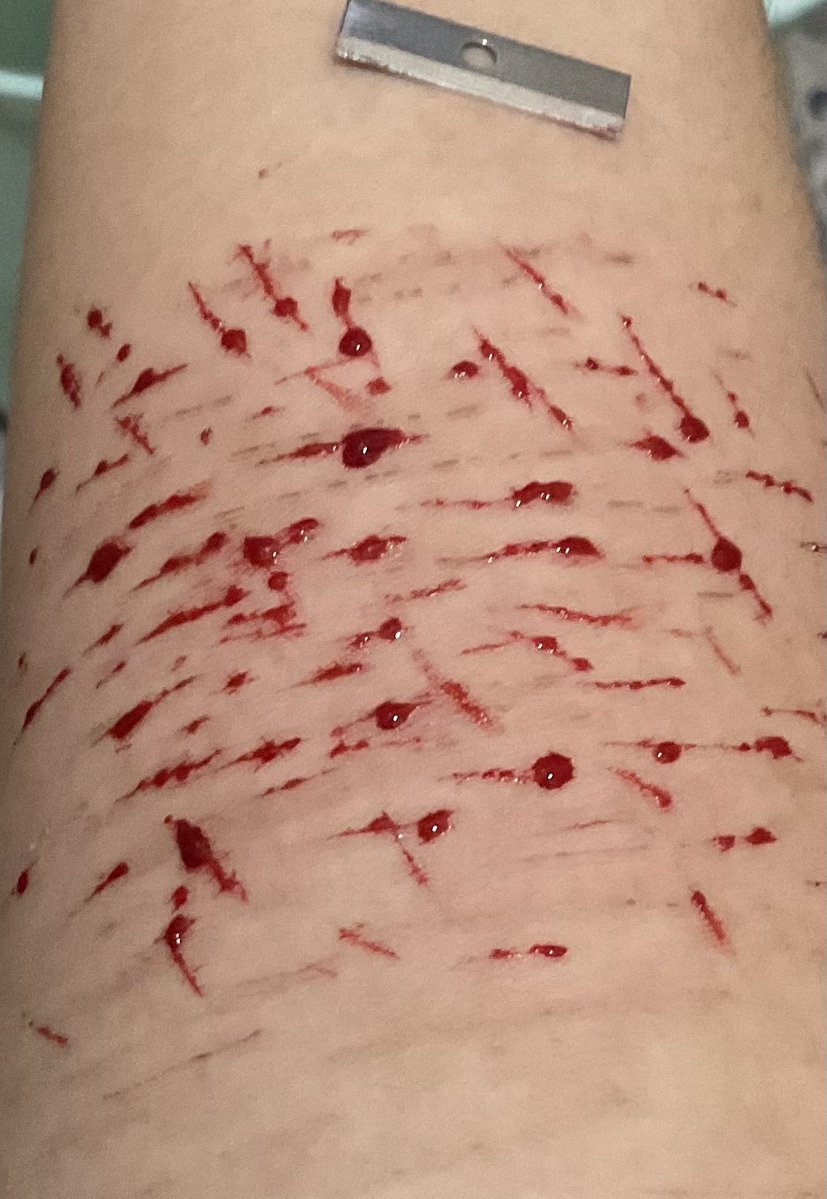 happiesturethan's tweet photo. FAKE REALISTIC SFX MAKEUP‼️‼️
So im serious, i did this while i was pooping. Double task😛✌️ #fake #shtwt #slittwt #cuttwt #ouchietwt #cut #makeup #slit https://t.co/1zMLOzXEKb